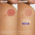 A-Derma Epithelia Ult Rep Cr 100Ml,