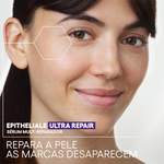 A-Derma Epithelia Ult Rep SerMultAH30Ml,
