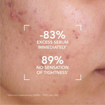 Sensibio Bioderma Forte Cr 40 Ml