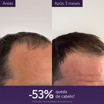 Caudalie Anti-Hair Loss Serum 50Ml,   x 1