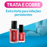 Excilor Forte Col Verniz Fung Verm 30Ml