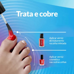Excilor Forte Col Verniz Fung Verm 30Ml