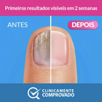 Excilor Sol Fungica Unhas 3,3Ml