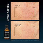 Filorga DailyPeel Sol Ren Antimanchas50,   x 1