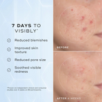 Medik8 Niacinamide Peptides Serum 30Ml,   x 1