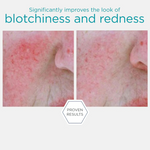 Neostrata Serum Envelh Vermelh 29g