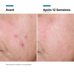 Skinceut Advanced RGN-6 Creme 50Ml,