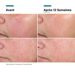 Skinceut Advanced RGN-6 Creme 50Ml,