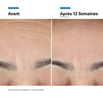 Skinceut Advanced RGN-6 Creme 50Ml,