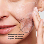 Skinceut Clean Glycolic Renewal Gel150Ml