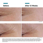 Skinceuticals Correct P-Tiox Sérum 30Ml