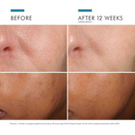 Skinceut Prevent Phloretin Cf 30ml