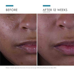 Skinceut Prevent Silymarin Cf 30Ml