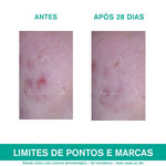 Uriage Hyseac  3-Regul 40ml